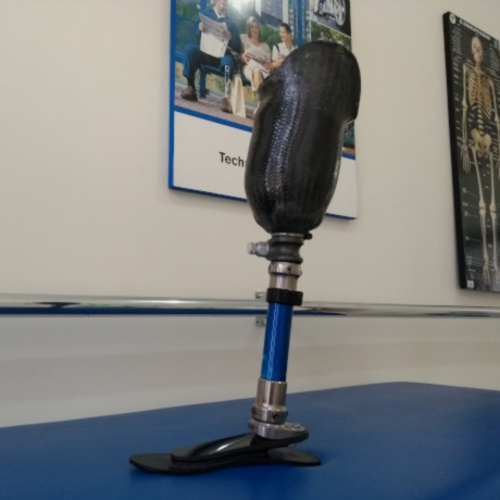 Prótesis transtibial en Carbono